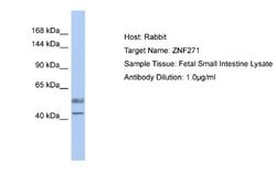 ZNF93 Rabbit anti-Human, Polyclonal, Novus Biologicals 0.1 mL | Buy Online | Novus Biologicals | Fisher Scientific